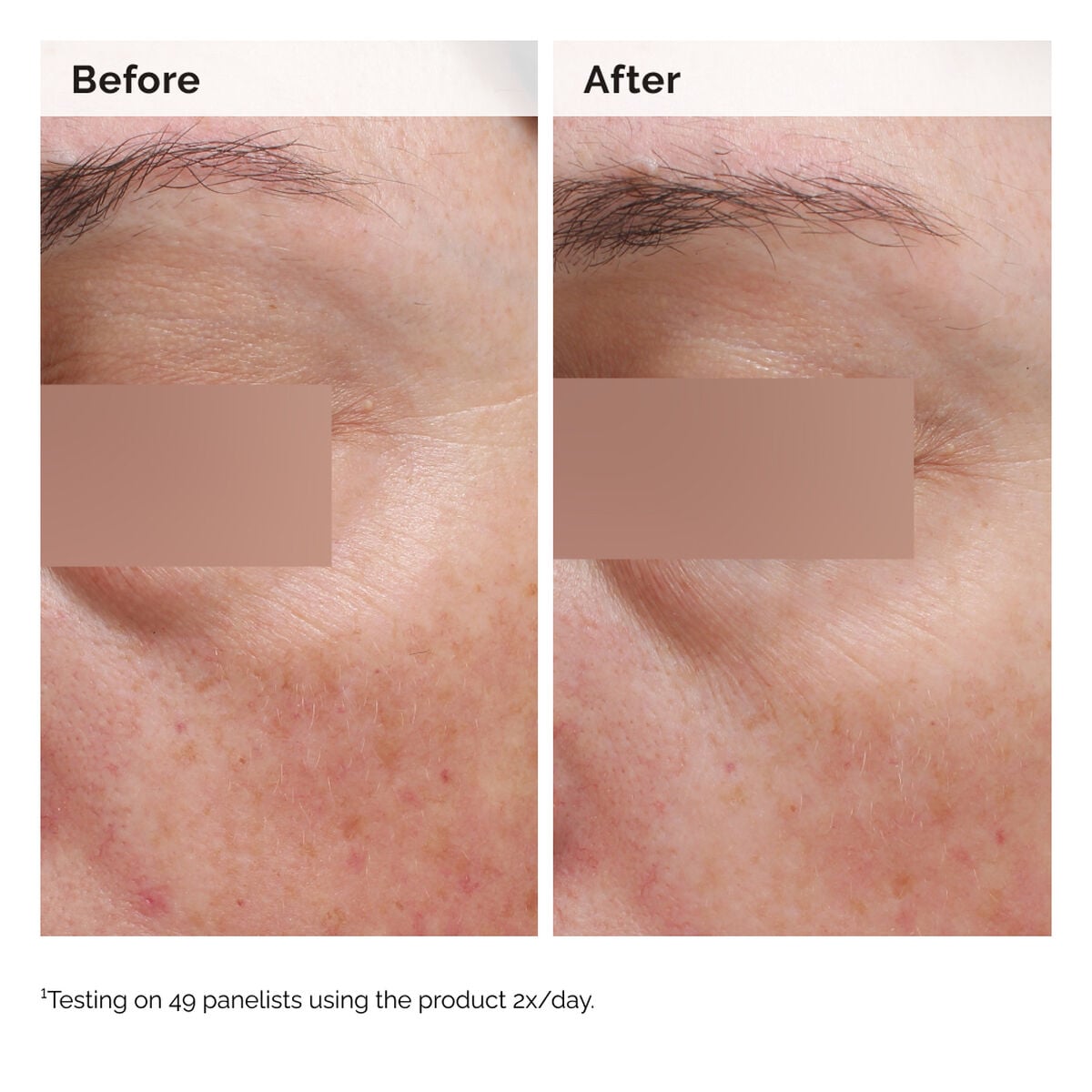 niacinamide-5-face-and-body-emulsion-e7 2024-08-23-ORD-Nia-5pct-Face-Body-B-A-Elasticity-Global-02-1x1.jpg