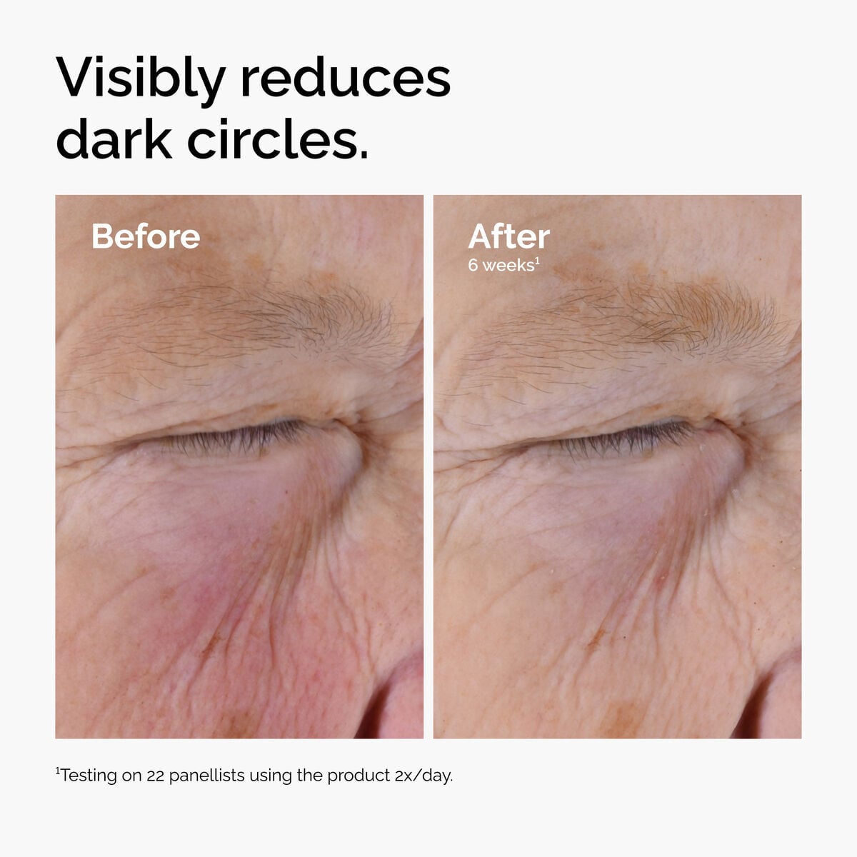 caffeine-solution-5-egcg-eye-serum-k5 ord-caffeine-solution-egcg-dark-circles-before-after.jpg