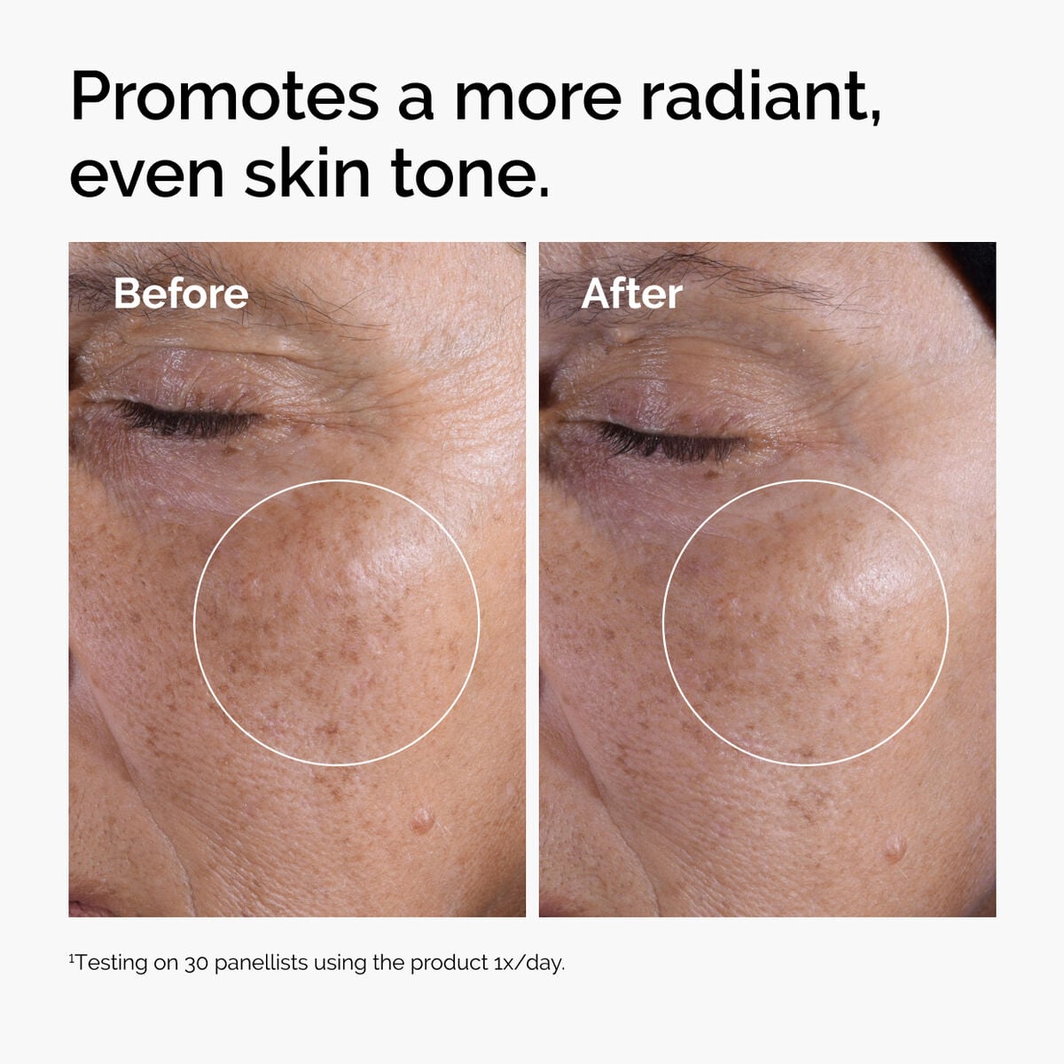 glycolic-acid-7-exfoliating-toner-d9 ord-glycolic-before-after-radiance.jpg
