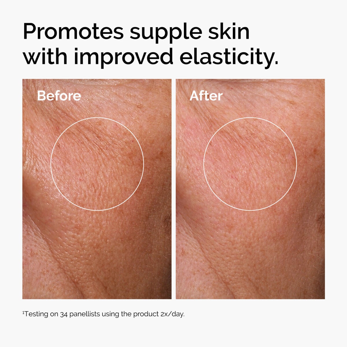 hyaluronic-acid-2-b5-with-ceramides-g8 ord-hyaluronic-acid-2pct-b5-hydrating-serum-before-after-elasticity.jpg