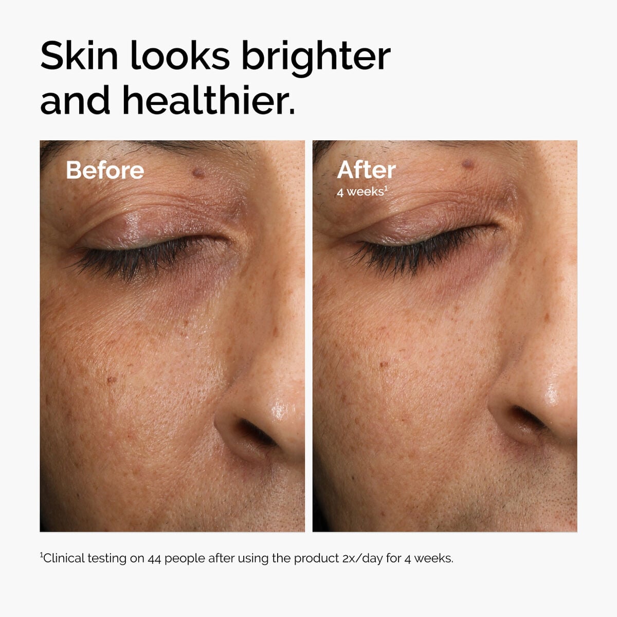 multi-antioxidant-radiance-serum-f7 ord-mars-before-after-healthy.jpg