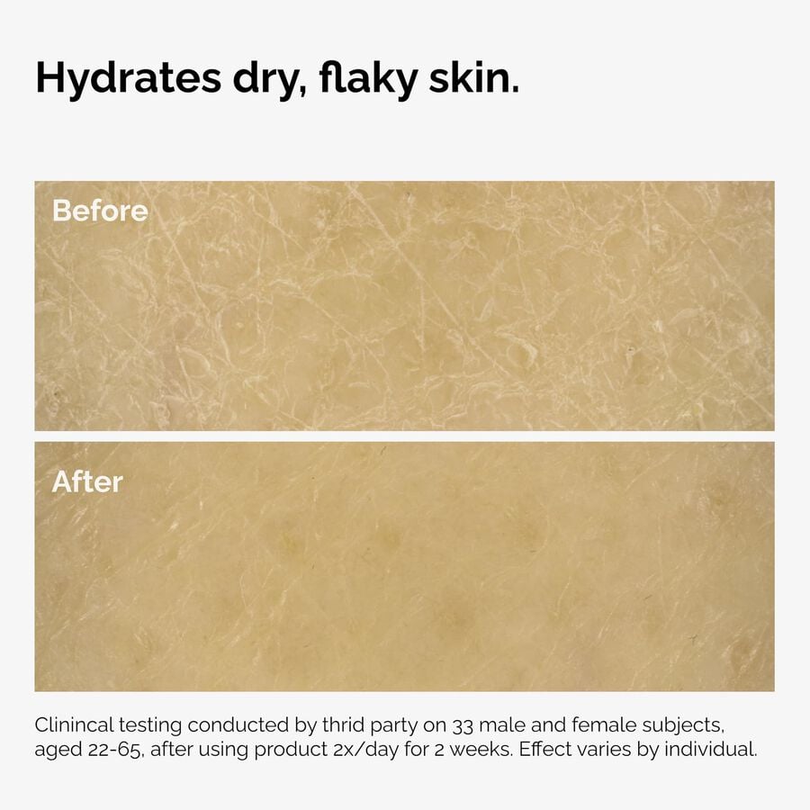 the-body-care-collection-t7 ord-natural-moisturizing-factors-inulin-body-before-after-graphic-02.jpg