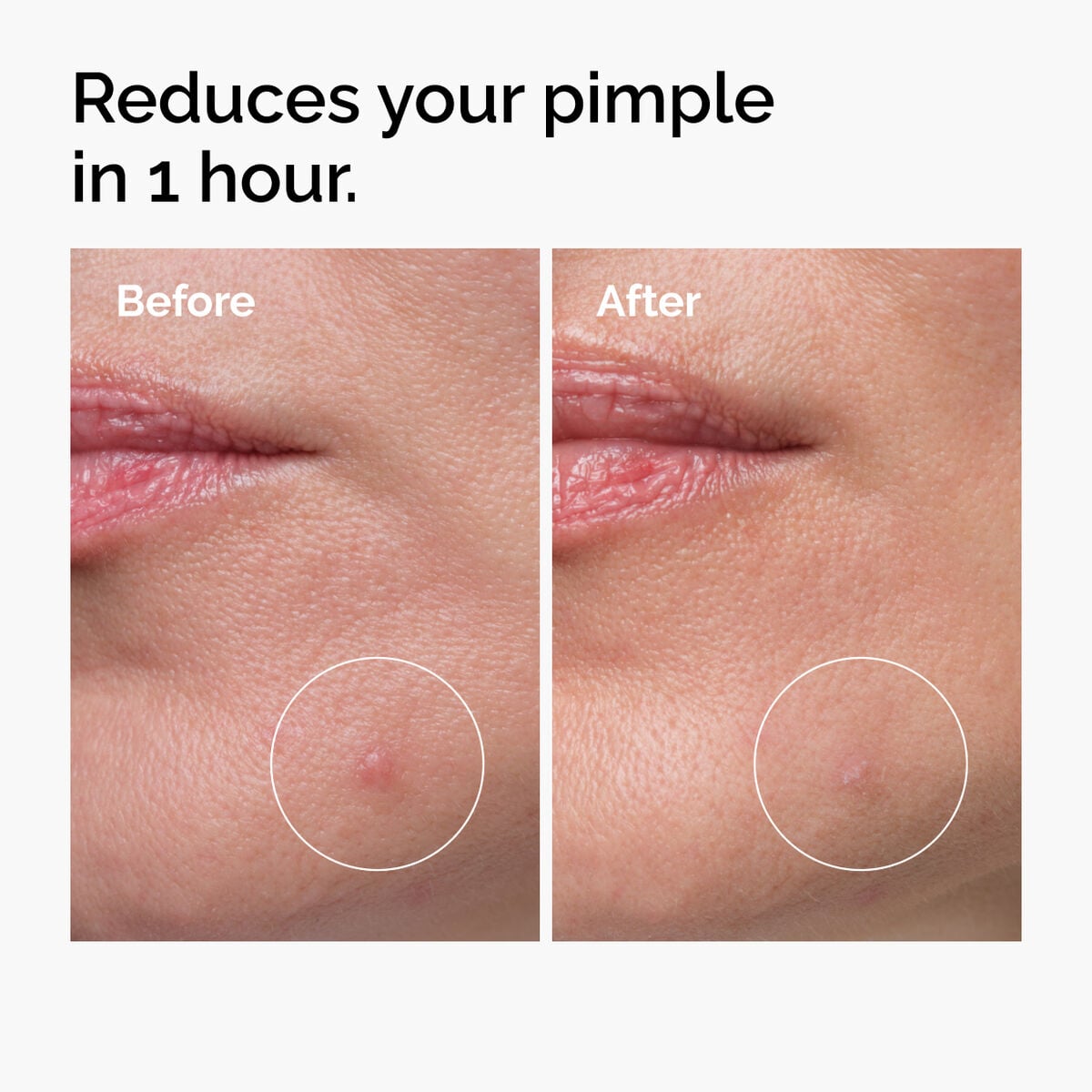 sulfur-10-powder-to-cream-concentrate-i1 ord-sulfur-10pct-powder-to-cream-concentrate-before-after-NA.jpg