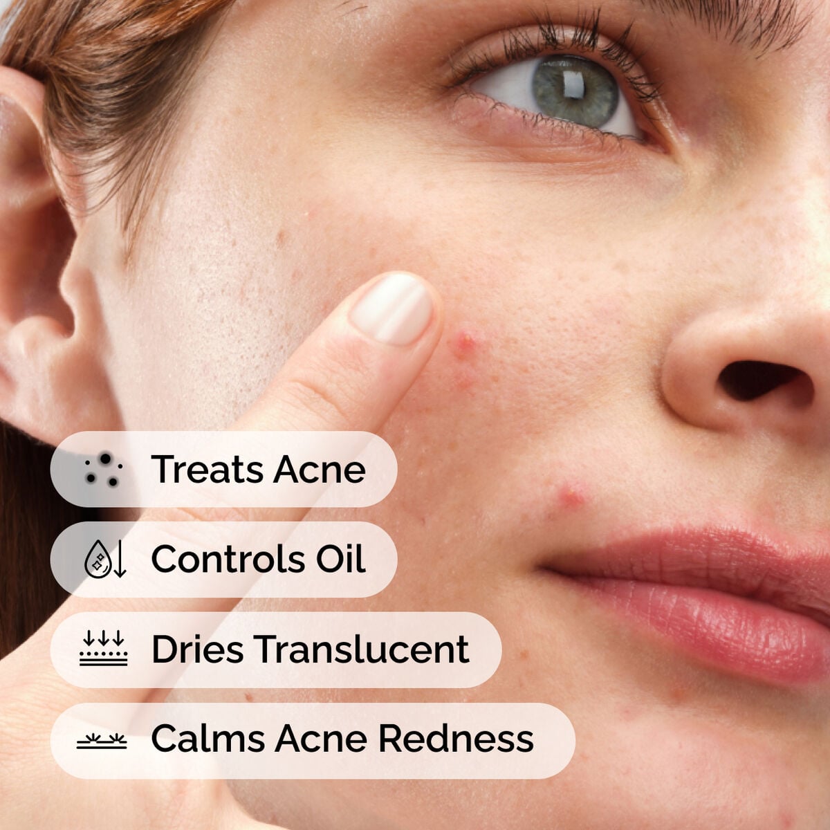 sulfur-10-powder-to-cream-concentrate-i1 ord-sulfur-10pct-powder-to-cream-concentrate-model-application-with-benefits-acne.jpg
